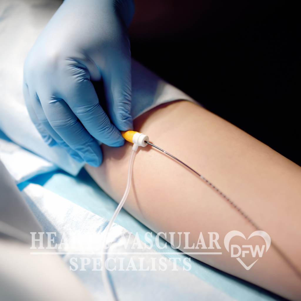 Deep Vein Thrombosis (DVT)​