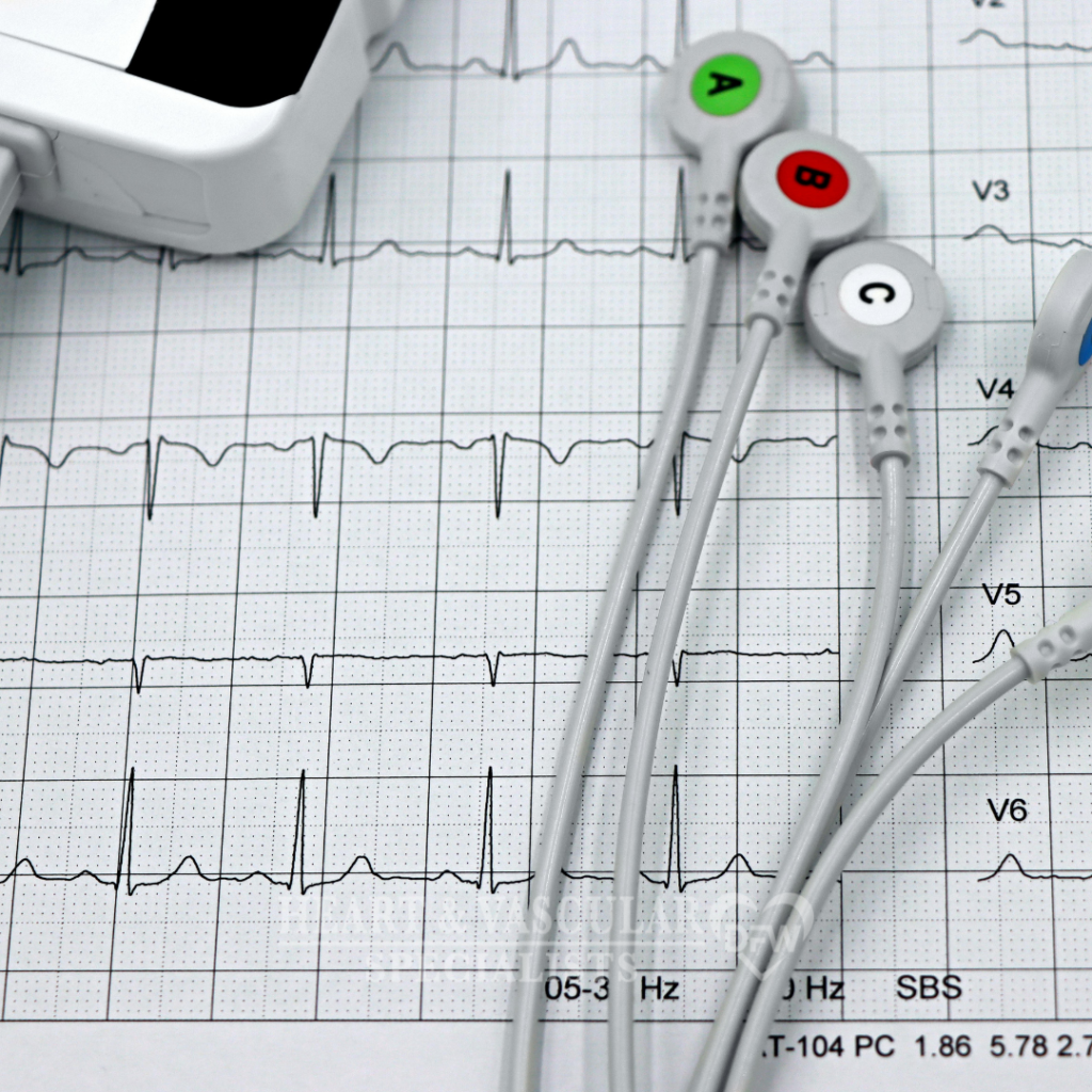 Electro-cardiogram (EKG_ECG)