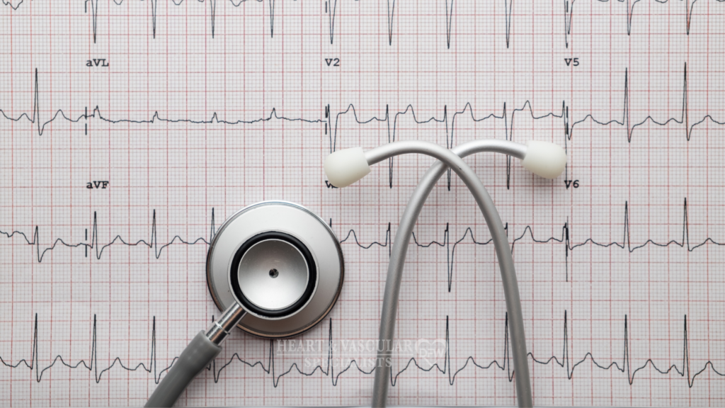 Electrocardiogram to evaluate irregular heartbeat