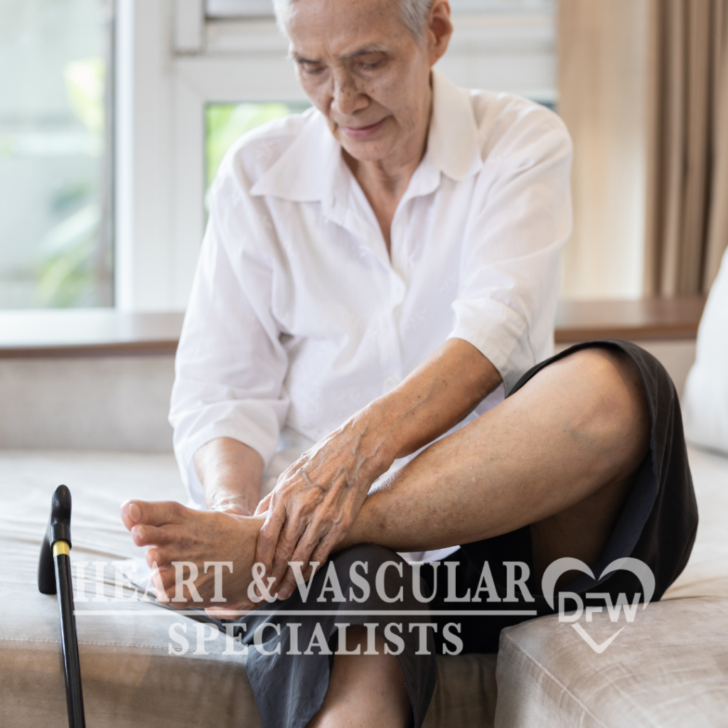 Peripheral Arterial Disease (PAD) ​