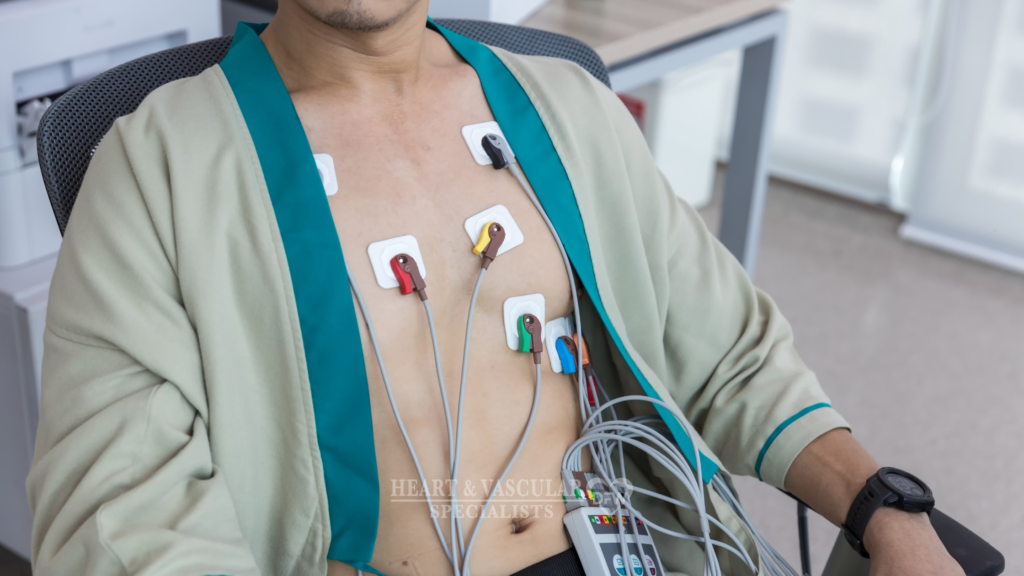 Stress testing to evaluate irregular heartbeat